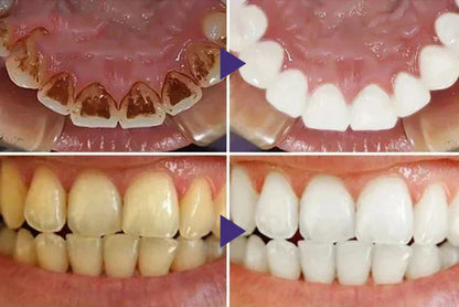 Oveallgo® ULTRA Gum Care Gel – Restore & Strengthen Your Gums