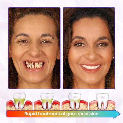 Oveallgo® BeeRenew Advanced Gum Healing Toothpaste