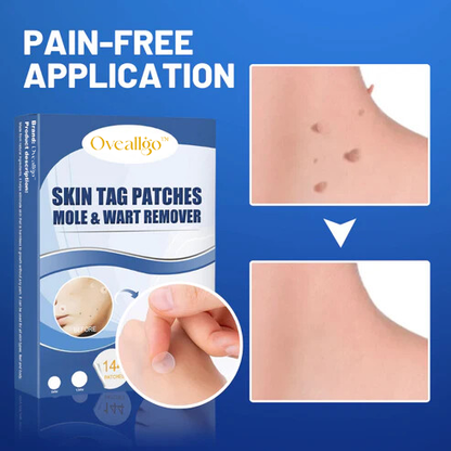 Oveallgo™ Moles & Warts Removing Skin Tag Patch