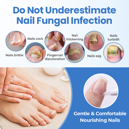 Fivfivgo® MycoErase Ultra Nail Revive Pen