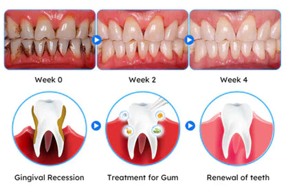 Oveallgo® ULTRA Gum Care Gel – Restore & Strengthen Your Gums