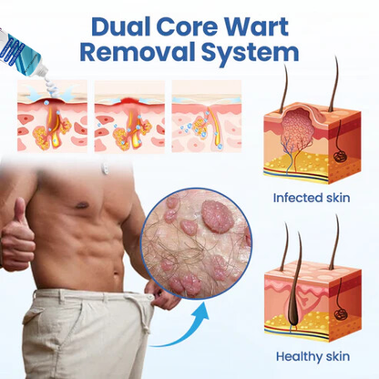 Oveallgo® GentX PRO WartRelief Cream