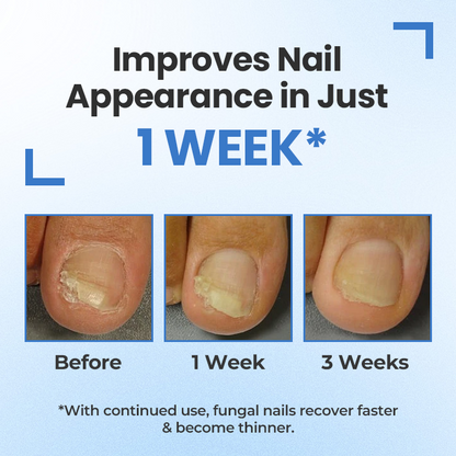 Fivfivgo® MycoErase Ultra Nail Revive Pen