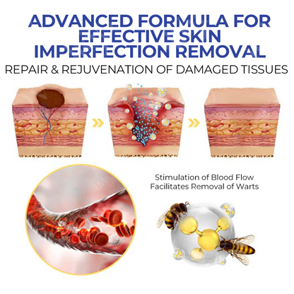 Oveallgo™ TagRecede Bee Venom Treatment Spray