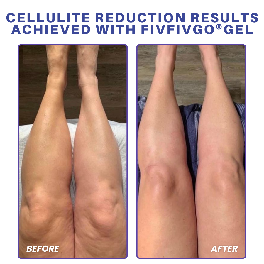 Fivfivgo® PDRN-GLP-1 Cellulite Targeting Reedle Shot Gel