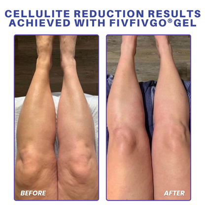Fivfivgo® PDRN-GLP-1 Cellulite Targeting Reedle Shot Gel