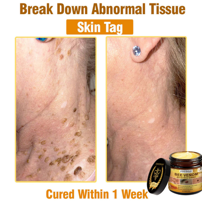 Fivfivgo® ULTRA Bee Venom All-In-One Cream