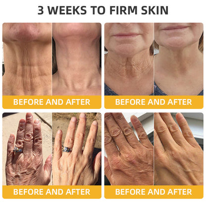 Oveallgo™ Apiotherapy Retinol Skin Salve Ointment 🐝𝐀𝐀𝐃 𝐑𝐄𝐂𝐎𝐌𝐌𝐄𝐍𝐃𝐒(🔥55% Off for a Limited Time!)