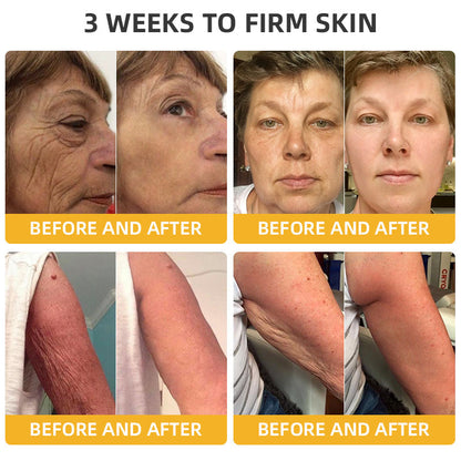Oveallgo™ Apiotherapy Retinol Skin Salve Ointment 🐝𝐀𝐀𝐃 𝐑𝐄𝐂𝐎𝐌𝐌𝐄𝐍𝐃𝐒(🔥55% Off for a Limited Time!)
