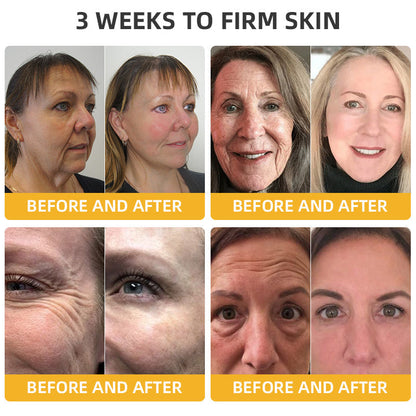 Oveallgo™ Apiotherapy Retinol Skin Salve Ointment 🐝𝐀𝐀𝐃 𝐑𝐄𝐂𝐎𝐌𝐌𝐄𝐍𝐃𝐒(🔥55% Off for a Limited Time!)