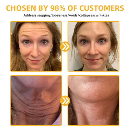 Oveallgo™ Apiotherapy Retinol Skin Salve Ointment 🐝𝐀𝐀𝐃 𝐑𝐄𝐂𝐎𝐌𝐌𝐄𝐍𝐃𝐒(🔥55% Off for a Limited Time!)