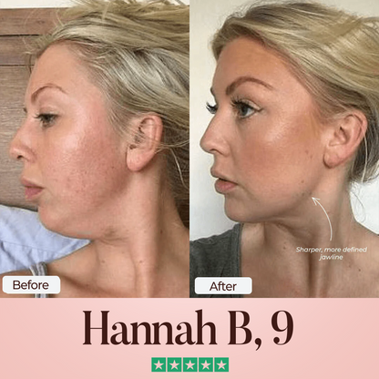 Oveallgo® SculptFix Ultra Mask Infused with Retinol & Collagen to Reveal Your Best Jawline