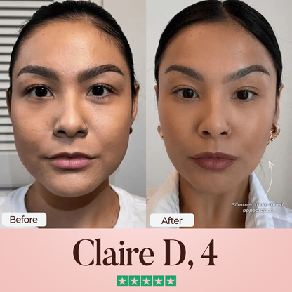 Oveallgo® SculptFix Ultra Mask Infused with Retinol & Collagen to Reveal Your Best Jawline