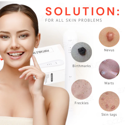 Oveallgo™ Portable Skin Care Laser Pen