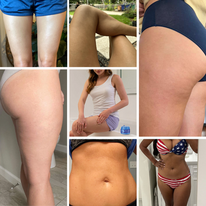 Fivfivgo® PDRN-GLP-1 Cellulite Targeting Reedle Shot Gel
