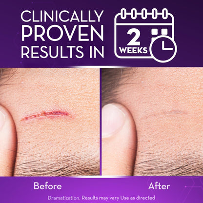 Oveallgo® Advanced Instant Scar Gel Improve The Appearance Of Scars And Stretch Marks