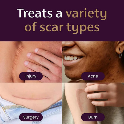 Oveallgo® Advanced Instant Scar Gel Improve The Appearance Of Scars And Stretch Marks