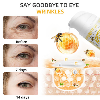 Oveallgo™ Apiotherapy Retinol Skin Salve Ointment 🐝𝐀𝐀𝐃 𝐑𝐄𝐂𝐎𝐌𝐌𝐄𝐍𝐃𝐒(🔥55% Off for a Limited Time!)
