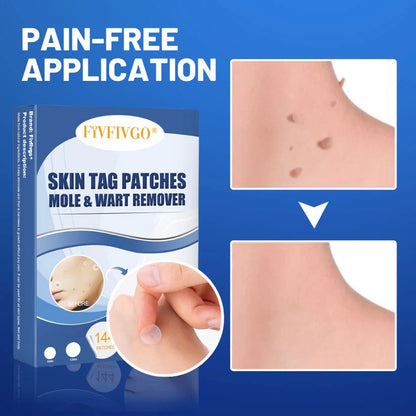 Fivfivgo® Advanced Moles & Warts Removing Skin Tag Patch